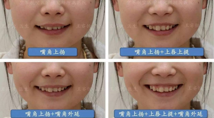 旅游自拍技巧 旅游自拍照片姿势大全 旅游自拍技巧 旅游自拍照片姿势大全